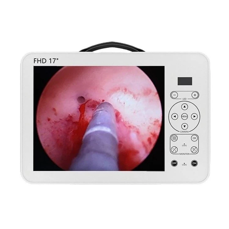 Ent Camera Medical Monitor Rau Endoscopy